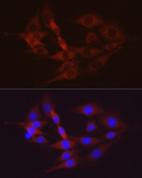 HK2 Antibody in Immunocytochemistry (ICC/IF)