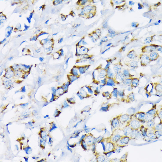 HK2 Antibody in Immunohistochemistry (Paraffin) (IHC (P))