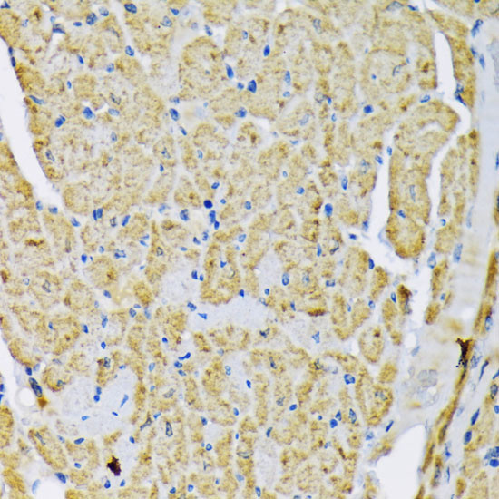 HK2 Antibody in Immunohistochemistry (Paraffin) (IHC (P))