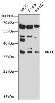 ART1 Antibody in Western Blot (WB)