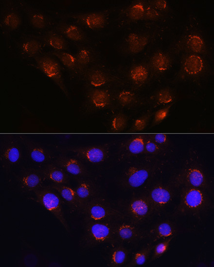 GOLGA4 Antibody in Immunocytochemistry (ICC/IF)