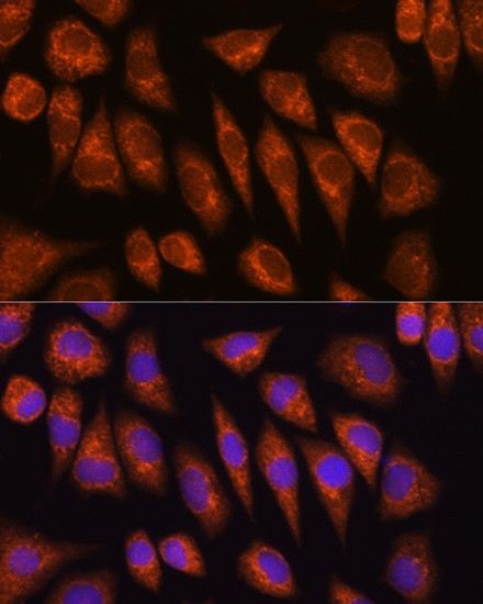 GOLGA4 Antibody in Immunocytochemistry (ICC/IF)