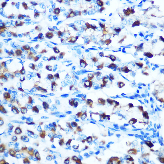 SLC11A2 Antibody in Immunohistochemistry (Paraffin) (IHC (P))