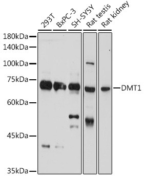 SLC11A2 Antibody in Western Blot (WB)