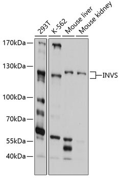 INVS Antibody in Western Blot (WB)