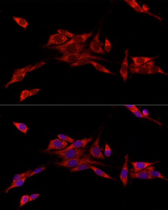 CISD1 Antibody in Immunocytochemistry (ICC/IF)