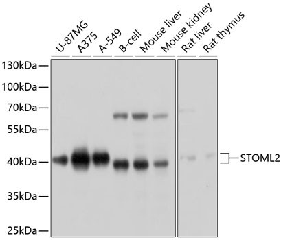 STOML2 Antibody in Western Blot (WB)