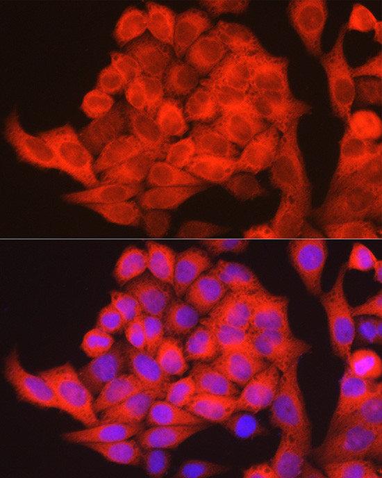 PHGDH Antibody in Immunocytochemistry (ICC/IF)