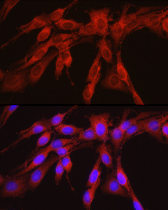 PHGDH Antibody in Immunocytochemistry (ICC/IF)