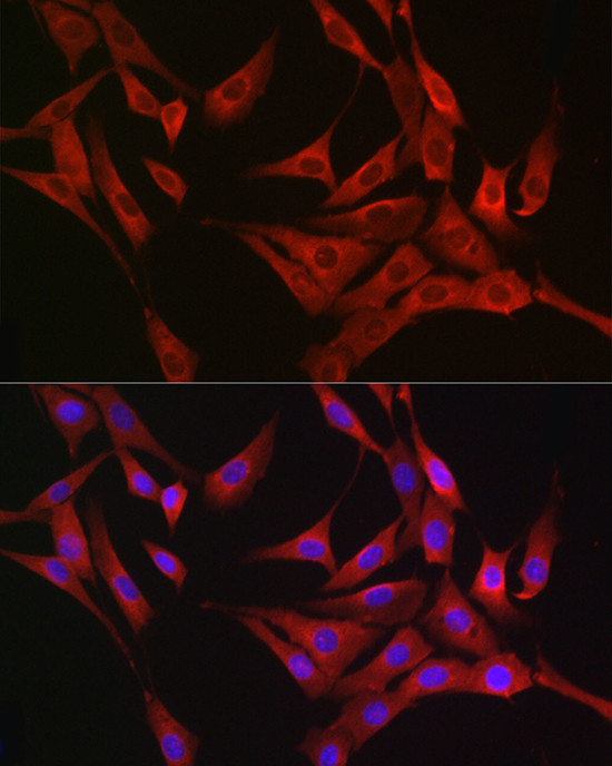 RASGRP1 Antibody in Immunocytochemistry (ICC/IF)