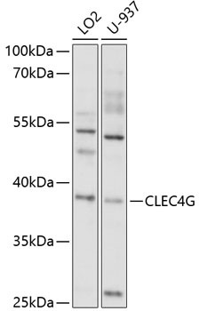 CLEC4G Antibody in Western Blot (WB)