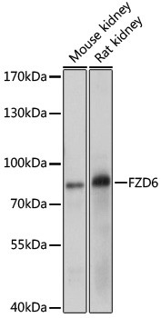 FZD6 Antibody in Western Blot (WB)