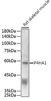 P4HA1 Antibody in Western Blot (WB)