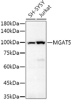 MGAT5 Antibody in Western Blot (WB)