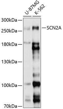 SCN2A Antibody in Western Blot (WB)