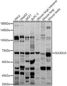 SLC6A14 Antibody in Western Blot (WB)