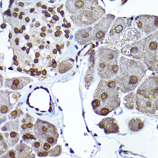 SEC14L2 Antibody in Immunohistochemistry (Paraffin) (IHC (P))