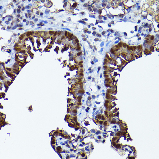 SEC14L2 Antibody in Immunohistochemistry (Paraffin) (IHC (P))