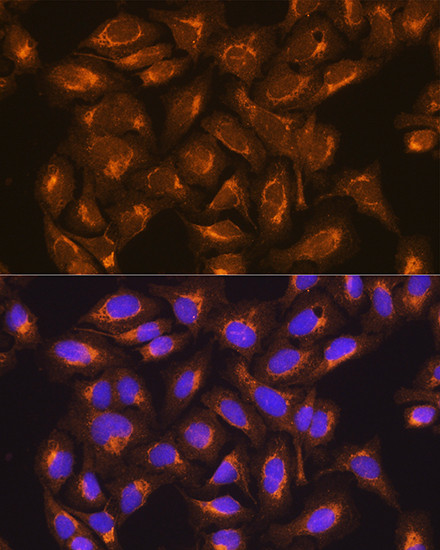 SDHB Antibody in Immunocytochemistry (ICC/IF)