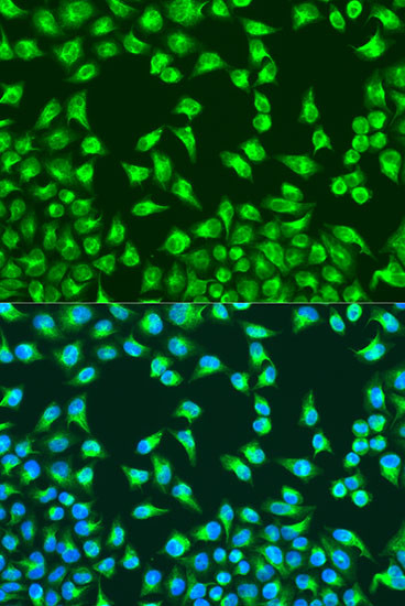 MTCO2 Antibody in Immunocytochemistry (ICC/IF)