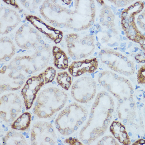 MTCO2 Antibody in Immunohistochemistry (Paraffin) (IHC (P))