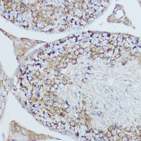 MTCO2 Antibody in Immunohistochemistry (Paraffin) (IHC (P))