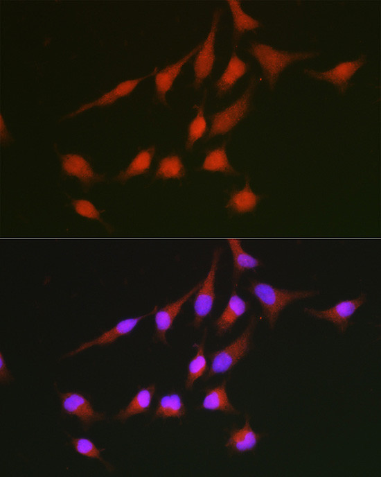 Nrf2 Polyclonal Antibody (PA5-88084)