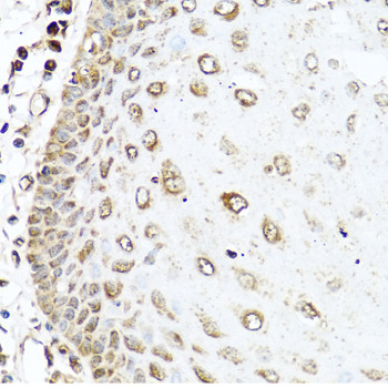 RAC2 Antibody in Immunohistochemistry (Paraffin) (IHC (P))