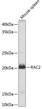 RAC2 Antibody in Western Blot (WB)