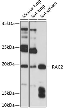 RAC2 Antibody in Western Blot (WB)