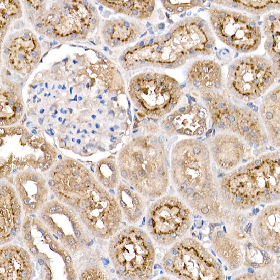 PYCARD Antibody in Immunohistochemistry (Paraffin) (IHC (P))