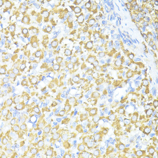 SQSTM1 Antibody in Immunohistochemistry (Paraffin) (IHC (P))