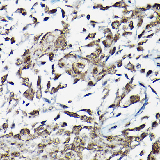 SMAD2 Antibody in Immunohistochemistry (Paraffin) (IHC (P))