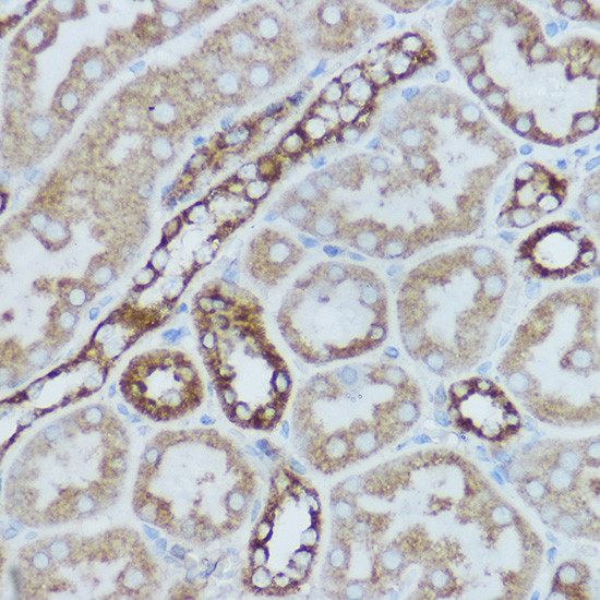 MTCO2 Antibody in Immunohistochemistry (Paraffin) (IHC (P))