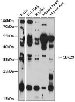 CDK20 Antibody in Western Blot (WB)