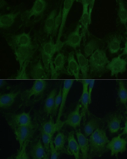 FABP7 Antibody in Immunocytochemistry (ICC/IF)