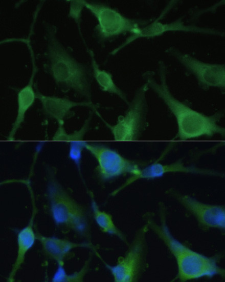 FABP7 Antibody in Immunocytochemistry (ICC/IF)