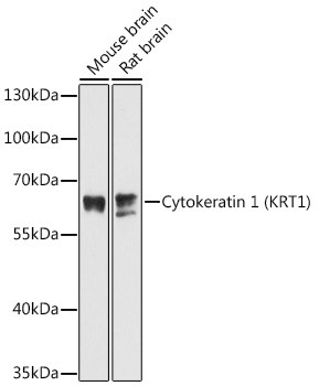 Cytokeratin 1 Antibody in Western Blot (WB)