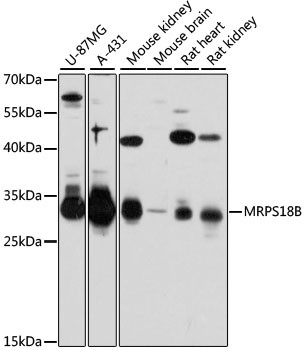 MRPS18B Antibody in Western Blot (WB)