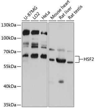 HSF2 Antibody in Western Blot (WB)