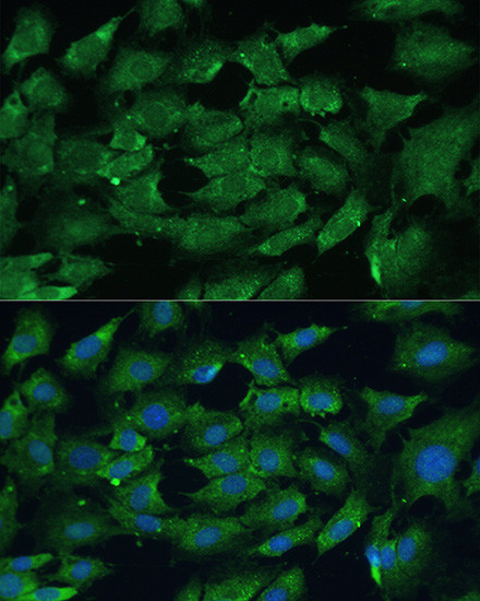 SHP2 Antibody in Immunocytochemistry (ICC/IF)