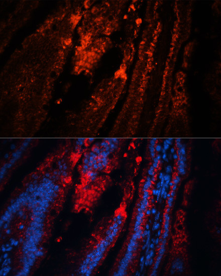 TRPA1 Antibody in Immunohistochemistry (Paraffin) (IHC (P))