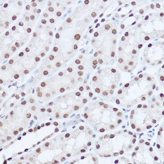 SAFB2 Antibody in Immunohistochemistry (Paraffin) (IHC (P))