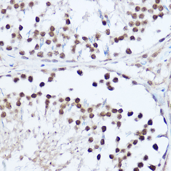 SAFB2 Antibody in Immunohistochemistry (Paraffin) (IHC (P))