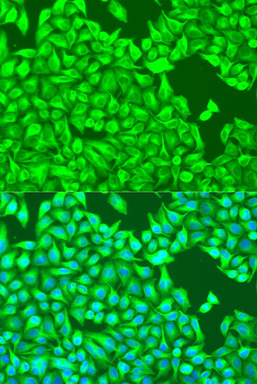 TUBB8 Antibody in Immunocytochemistry (ICC/IF)