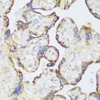 ECH1 Antibody in Immunohistochemistry (Paraffin) (IHC (P))