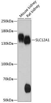 NKCC2 Antibody in Western Blot (WB)