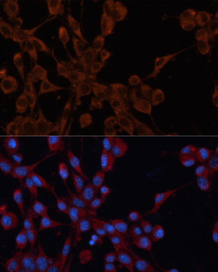 IGF2R Antibody in Immunocytochemistry (ICC/IF)