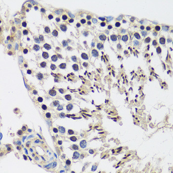 Casc5 Antibody in Immunohistochemistry (Paraffin) (IHC (P))