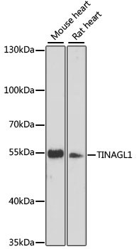 TINAGL1 Antibody in Western Blot (WB)